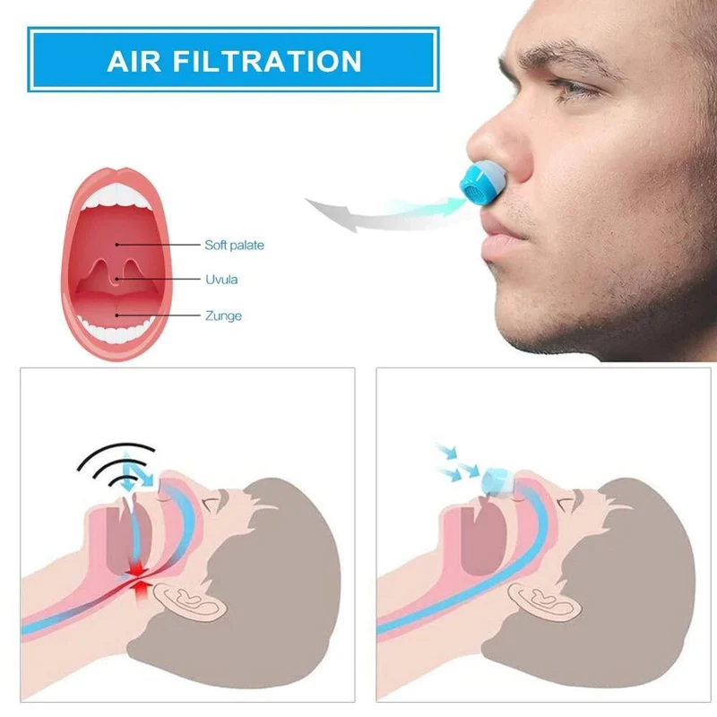 Anti-Snurkapparaat | Slangloos, maskerloos Micro-CPAP