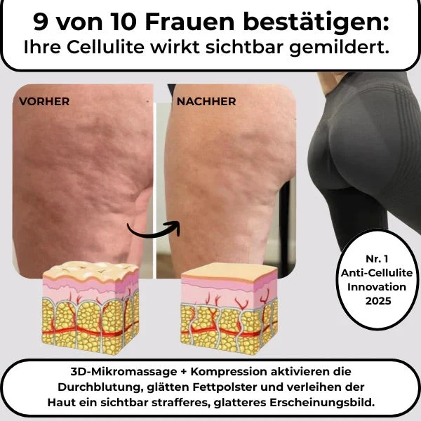 CompresFit | Premium Compressie Leggings voor Verbeterde Prestaties