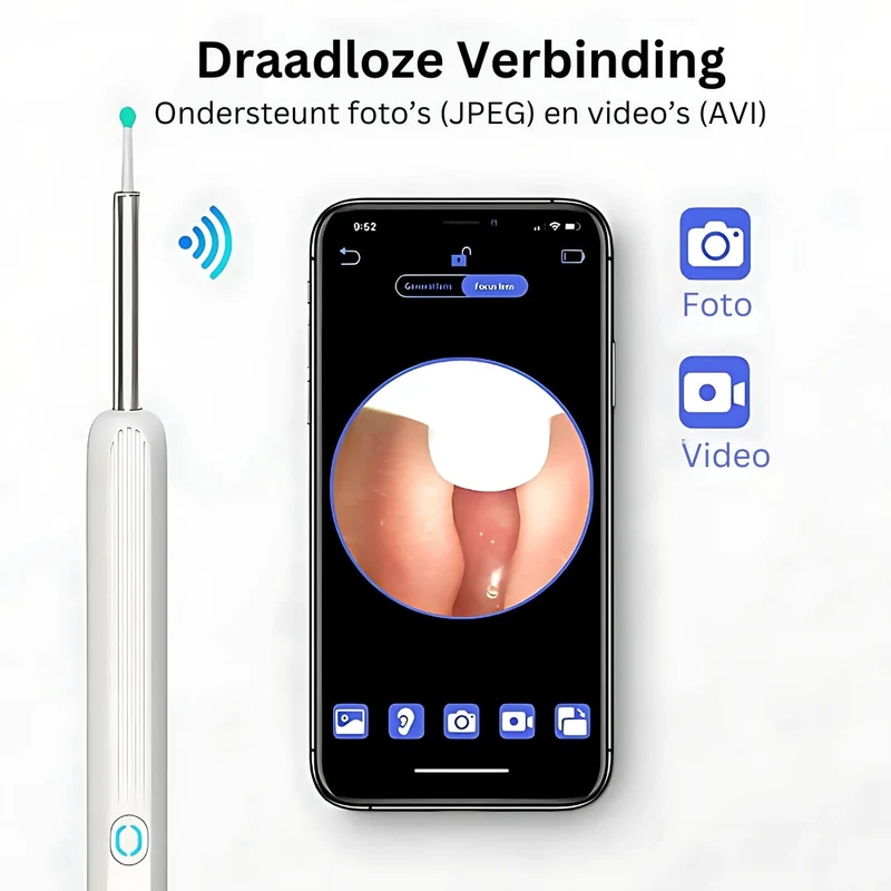 AureliaVision Luxe Oorreiniger | HD-camera voor een grondige oorreiniging